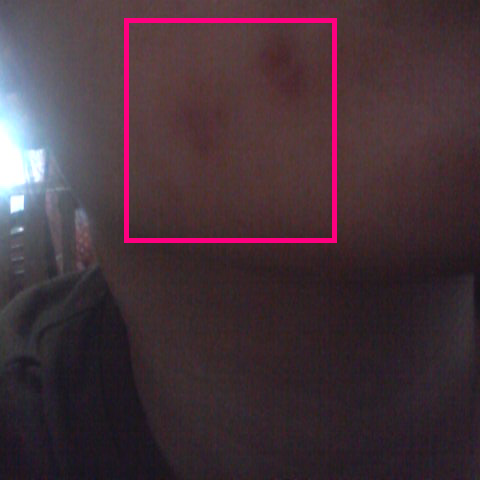 Kulit muka sudah cacat meh!!
